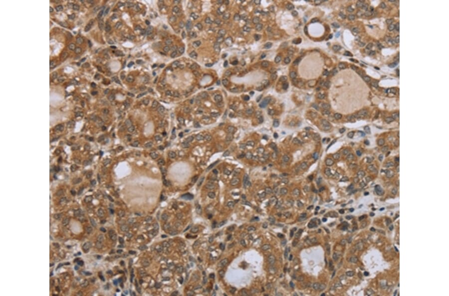 Immunohistochemistry - NDUFS2 Antibody from Signalway Antibody (37757) - Antibodies.com