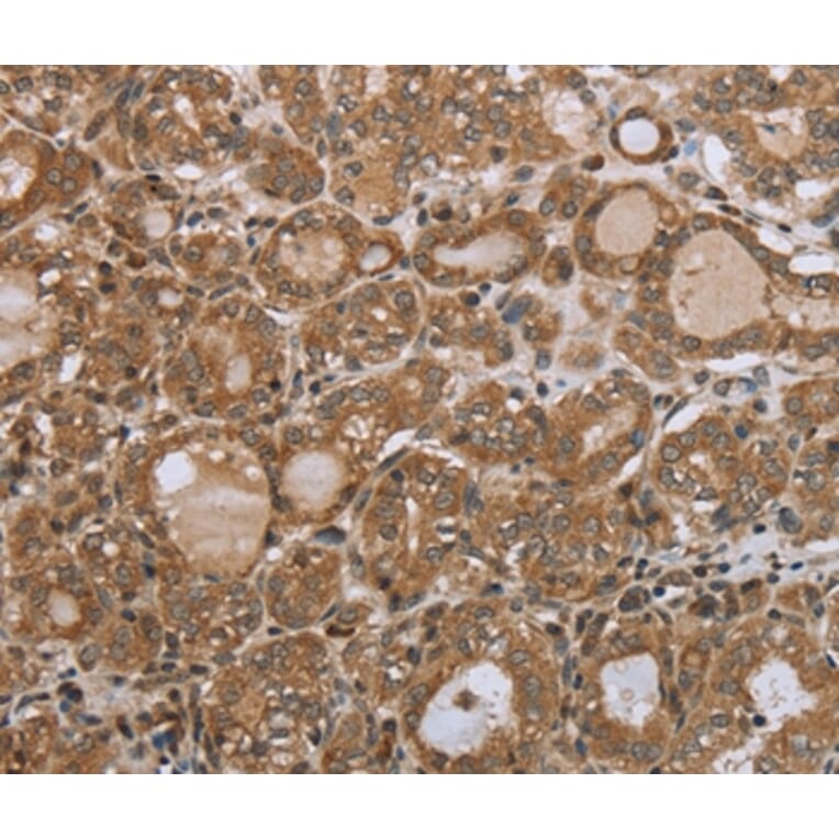 Immunohistochemistry - NDUFS2 Antibody from Signalway Antibody (37757) - Antibodies.com