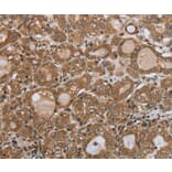 Immunohistochemistry - NDUFS2 Antibody from Signalway Antibody (37757) - Antibodies.com