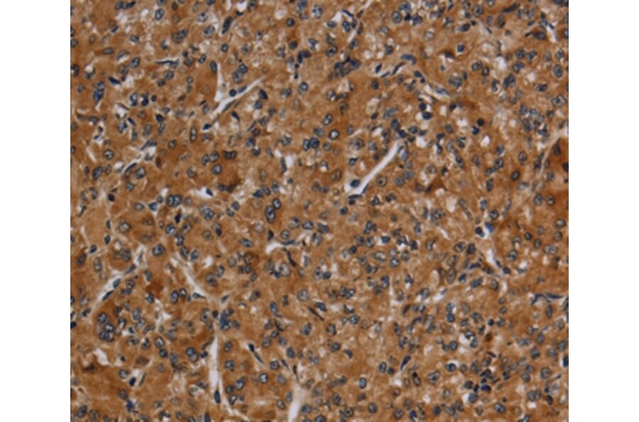 Immunohistochemistry - CYP1A2 Antibody from Signalway Antibody (37789) - Antibodies.com