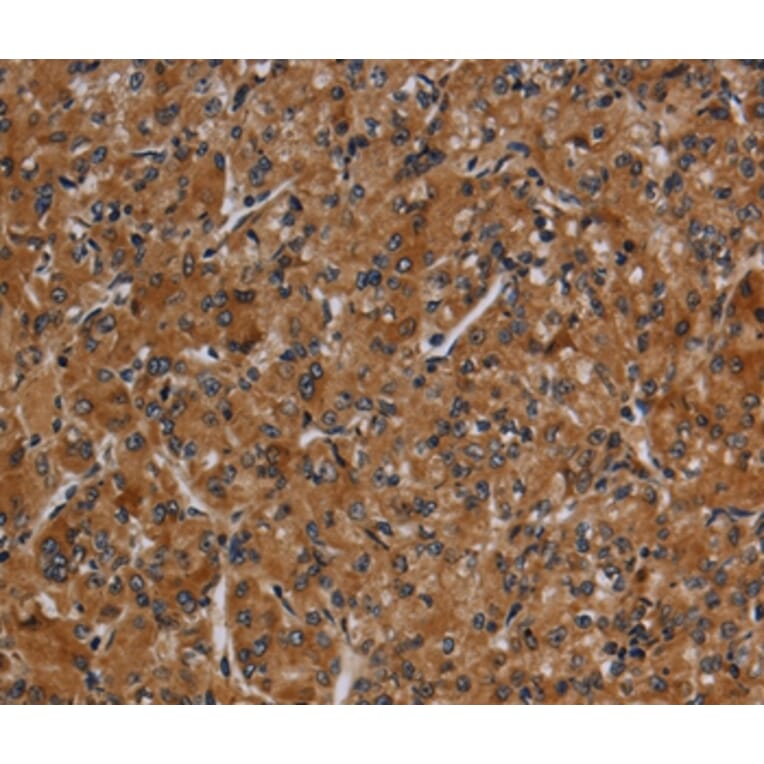 Immunohistochemistry - CYP1A2 Antibody from Signalway Antibody (37789) - Antibodies.com