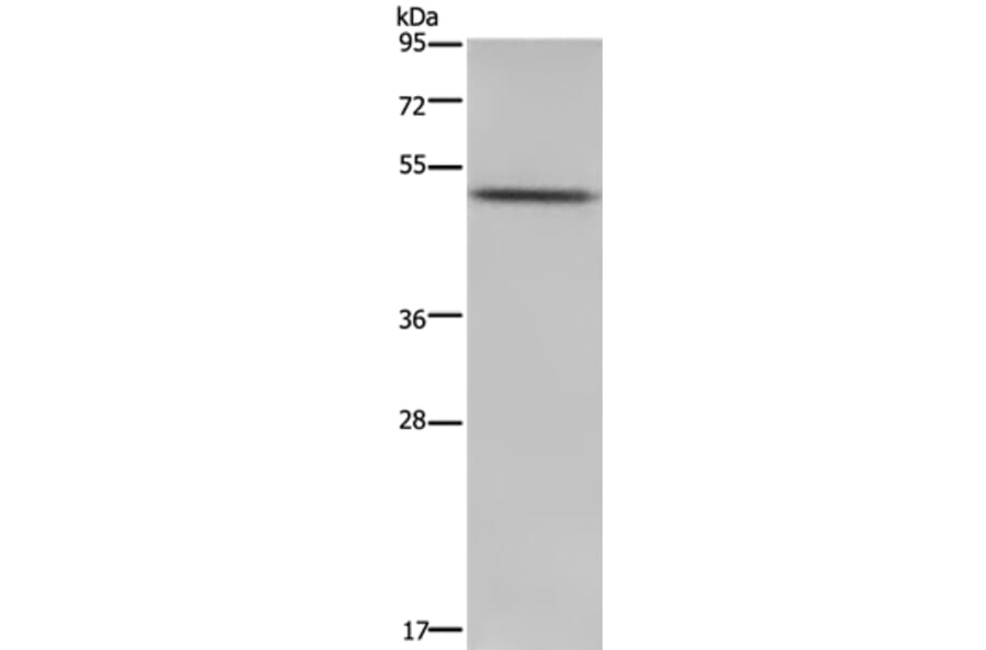 PKMYT1 Antibody from Signalway Antibody (37829) - Antibodies.com
