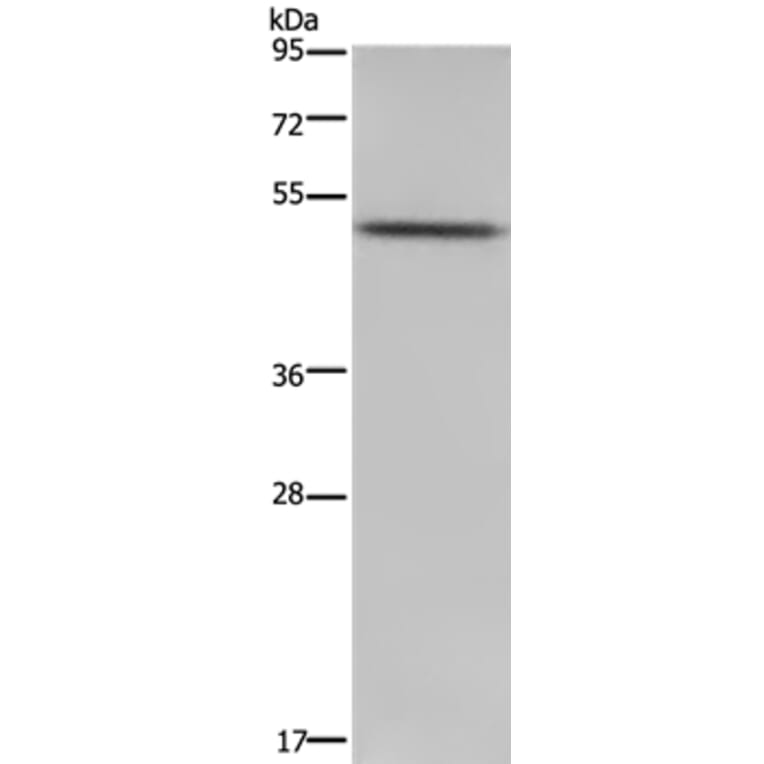 PKMYT1 Antibody from Signalway Antibody (37829) - Antibodies.com