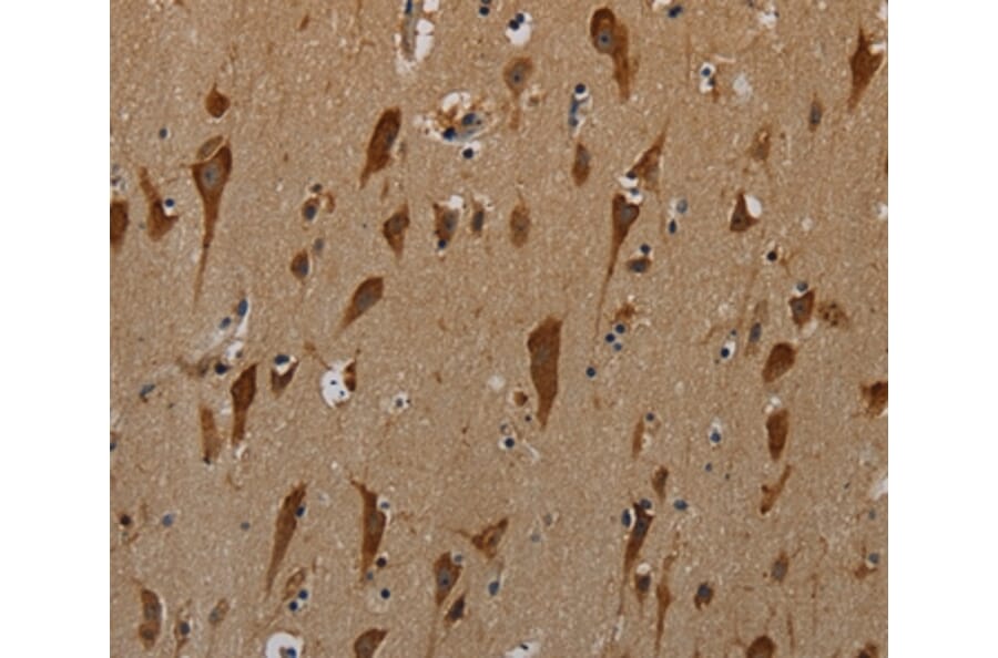 Immunohistochemistry - PKMYT1 Antibody from Signalway Antibody (37829) - Antibodies.com