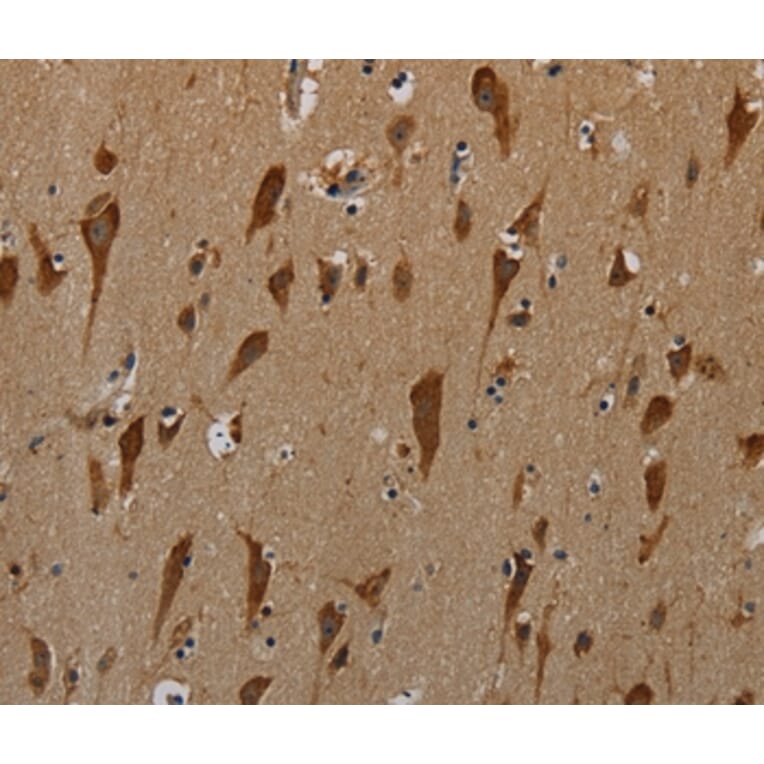 Immunohistochemistry - PKMYT1 Antibody from Signalway Antibody (37829) - Antibodies.com