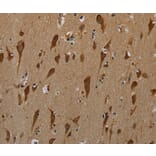 Immunohistochemistry - PKMYT1 Antibody from Signalway Antibody (37829) - Antibodies.com