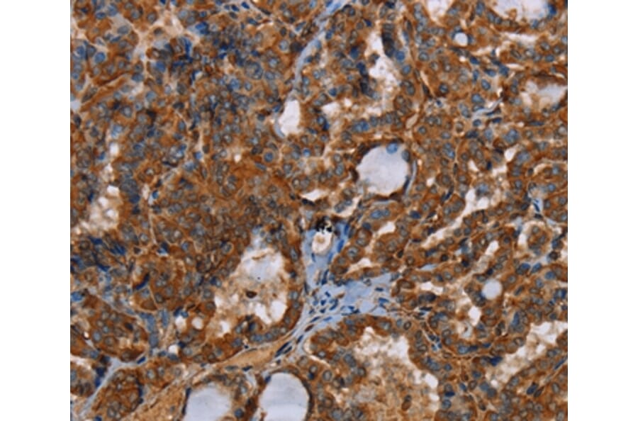 Immunohistochemistry - POU6F2 Antibody from Signalway Antibody (37841) - Antibodies.com