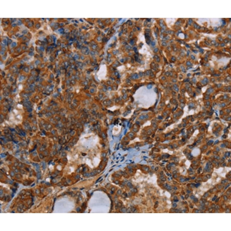 Immunohistochemistry - POU6F2 Antibody from Signalway Antibody (37841) - Antibodies.com