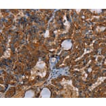 Immunohistochemistry - POU6F2 Antibody from Signalway Antibody (37841) - Antibodies.com