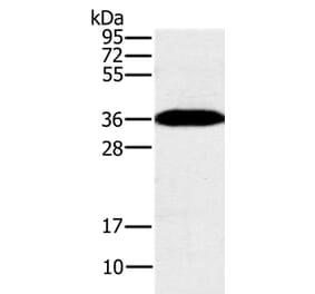 PPP1CC Antibody from Signalway Antibody (37842) - Antibodies.com