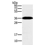 PPP1CC Antibody from Signalway Antibody (37842) - Antibodies.com