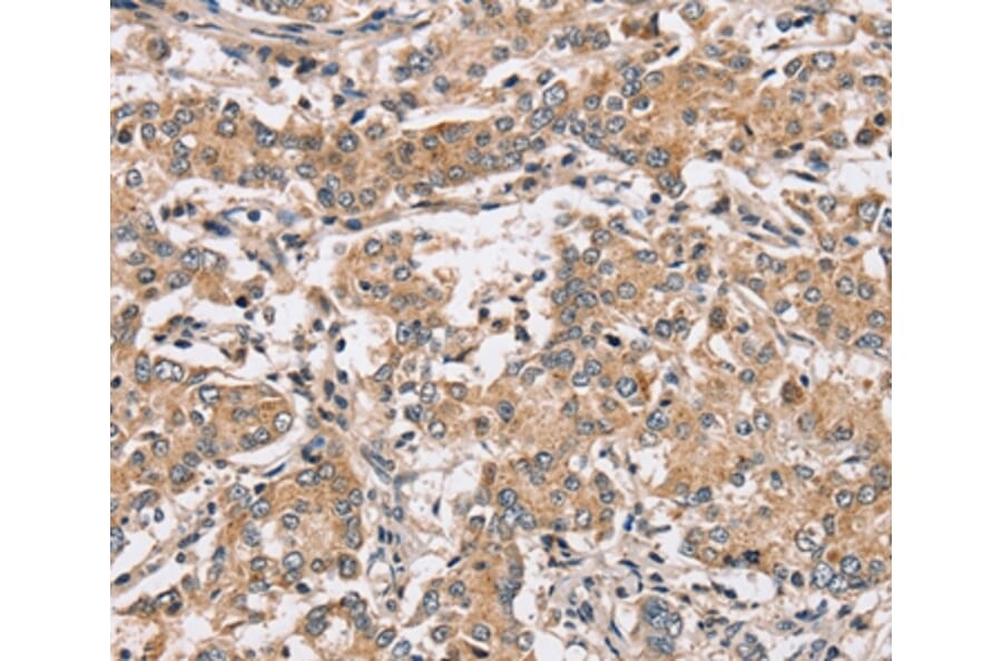 Immunohistochemistry - PPP1CC Antibody from Signalway Antibody (37842) - Antibodies.com