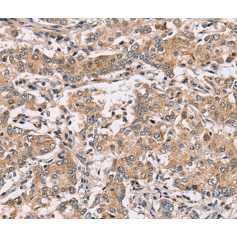 Immunohistochemistry - PPP1CC Antibody from Signalway Antibody (37842) - Antibodies.com