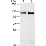 PTPN12 Antibody from Signalway Antibody (37849) - Antibodies.com