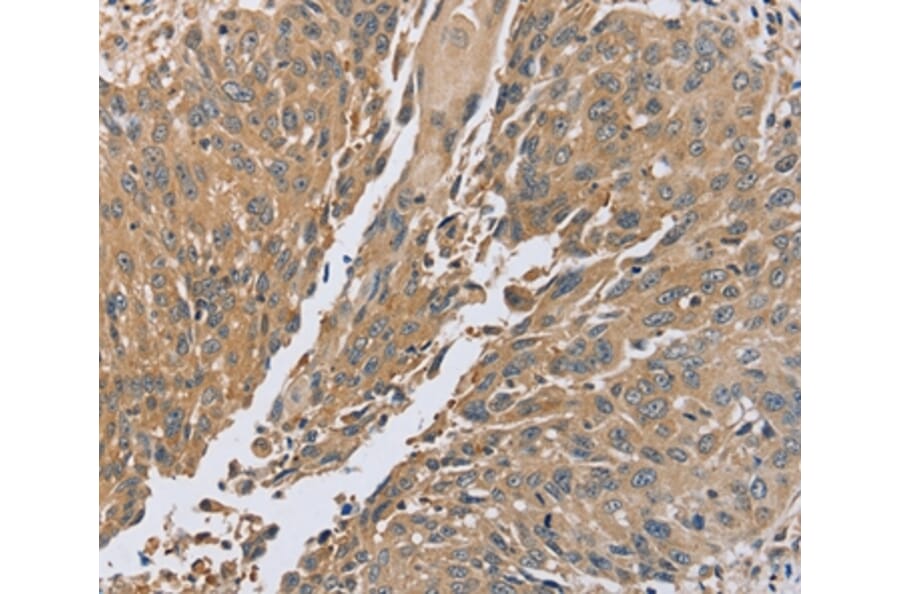 Immunohistochemistry - PTPN12 Antibody from Signalway Antibody (37849) - Antibodies.com