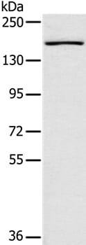 Gel: 6%SDS-PAGE Lysates (from left to right): Human colon cancer tissue Amount of lysate: 40ug per lane Primary antibody: 1/300 dilution Secondary antibody dilution: 1/8000 Exposure time: 30 seconds