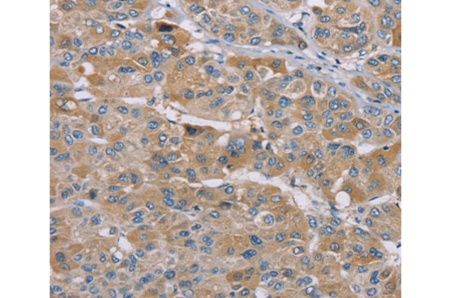 Immunohistochemistry - SAMD9L Antibody from Signalway Antibody (37892) - Antibodies.com