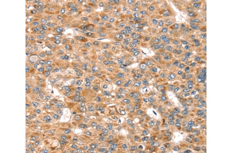 Immunohistochemistry - SEMA7A Antibody from Signalway Antibody (37908) - Antibodies.com