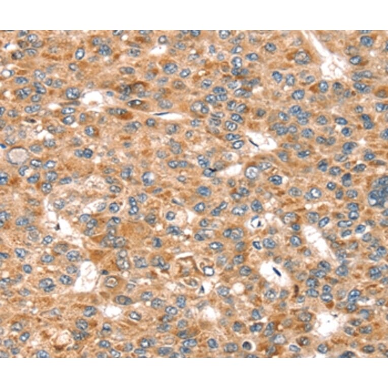 Immunohistochemistry - SEMA7A Antibody from Signalway Antibody (37908) - Antibodies.com