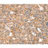 Immunohistochemistry - SEMA7A Antibody from Signalway Antibody (37908) - Antibodies.com