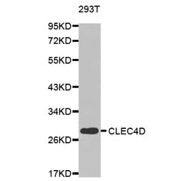 Western blot - CLEC4D antibody from Signalway Antibody (38441) - Antibodies.com