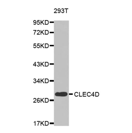 Western blot - CLEC4D antibody from Signalway Antibody (38441) - Antibodies.com