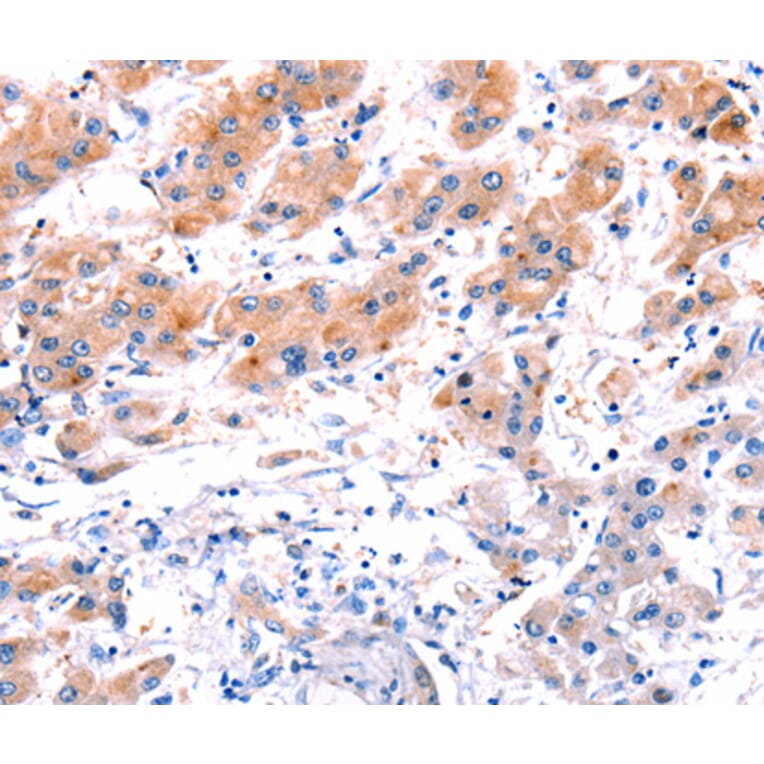Immunohistochemistry - CLEC4D antibody from Signalway Antibody (38441) - Antibodies.com