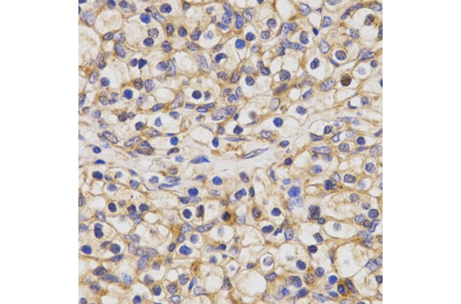 Immunohistochemistry - CLEC4D antibody from Signalway Antibody (38441) - Antibodies.com
