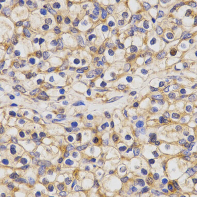 Immunohistochemistry - CLEC4D antibody from Signalway Antibody (38441) - Antibodies.com