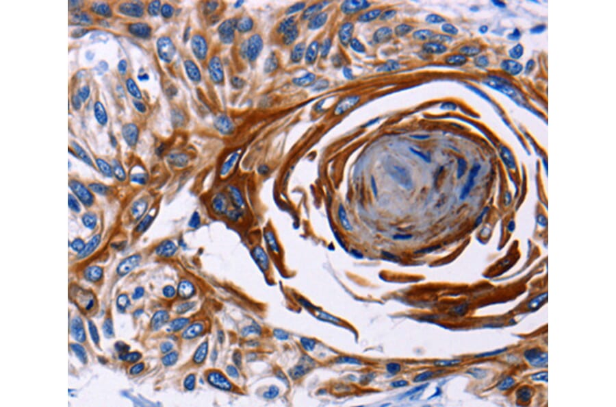 Immunohistochemistry - IL18R1 antibody from Signalway Antibody (38443) - Antibodies.com