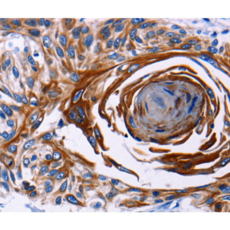 Immunohistochemistry - IL18R1 antibody from Signalway Antibody (38443) - Antibodies.com