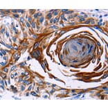 Immunohistochemistry - IL18R1 antibody from Signalway Antibody (38443) - Antibodies.com