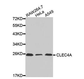 Western blot - CLEC4A antibody from Signalway Antibody (38445) - Antibodies.com
