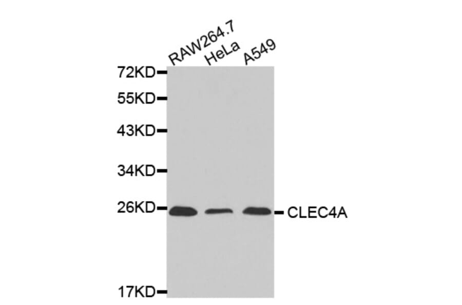 Western blot - CLEC4A antibody from Signalway Antibody (38445) - Antibodies.com