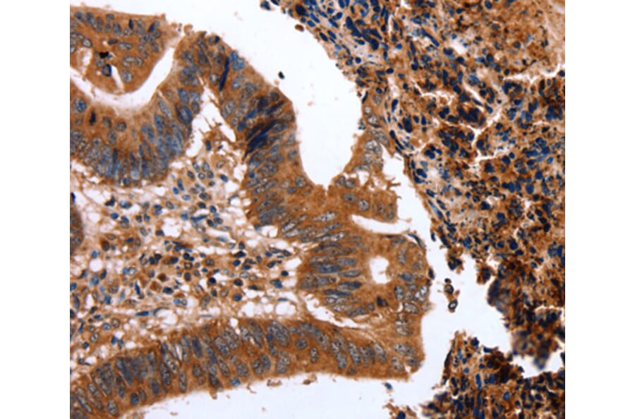 Immunohistochemistry - CLEC4A antibody from Signalway Antibody (38445) - Antibodies.com
