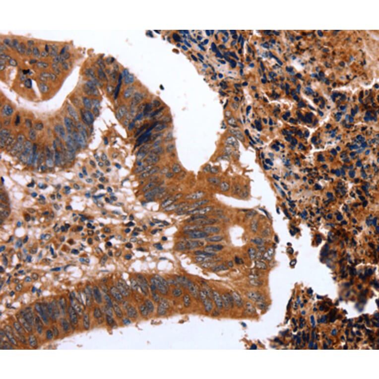 Immunohistochemistry - CLEC4A antibody from Signalway Antibody (38445) - Antibodies.com