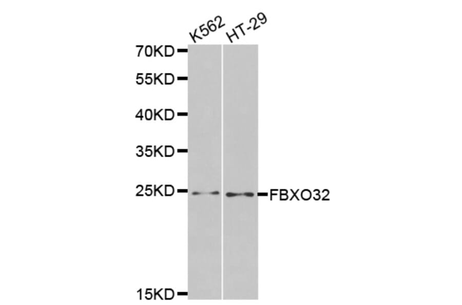 Western blot - FBXO32 antibody from Signalway Antibody (38459) - Antibodies.com