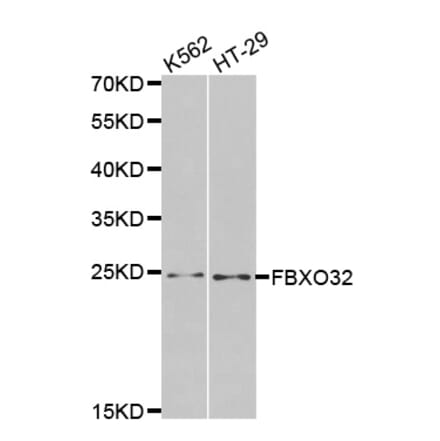 Western blot - FBXO32 antibody from Signalway Antibody (38459) - Antibodies.com
