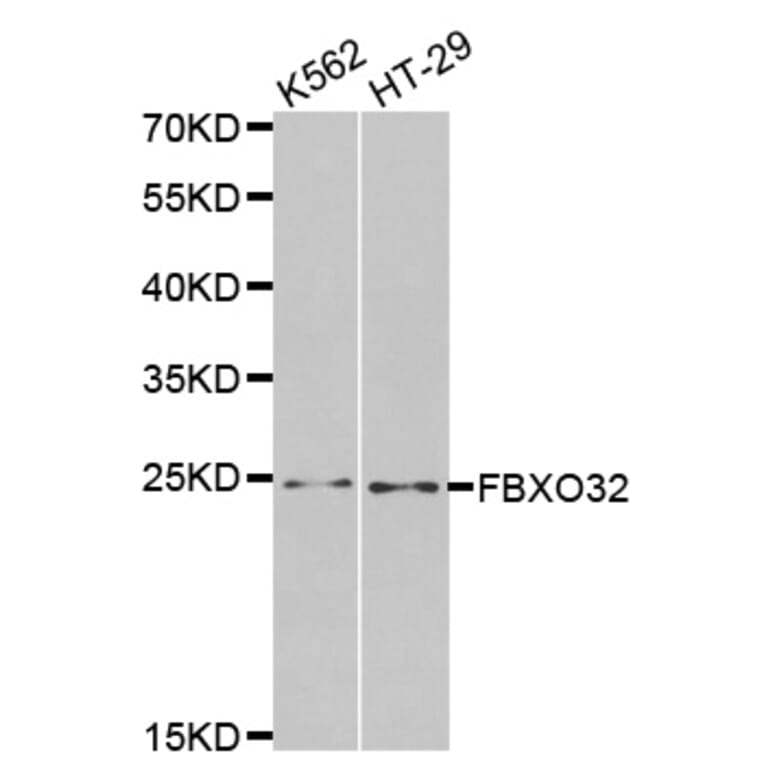 Western blot - FBXO32 antibody from Signalway Antibody (38459) - Antibodies.com
