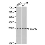 Western blot - FBXO32 antibody from Signalway Antibody (38459) - Antibodies.com