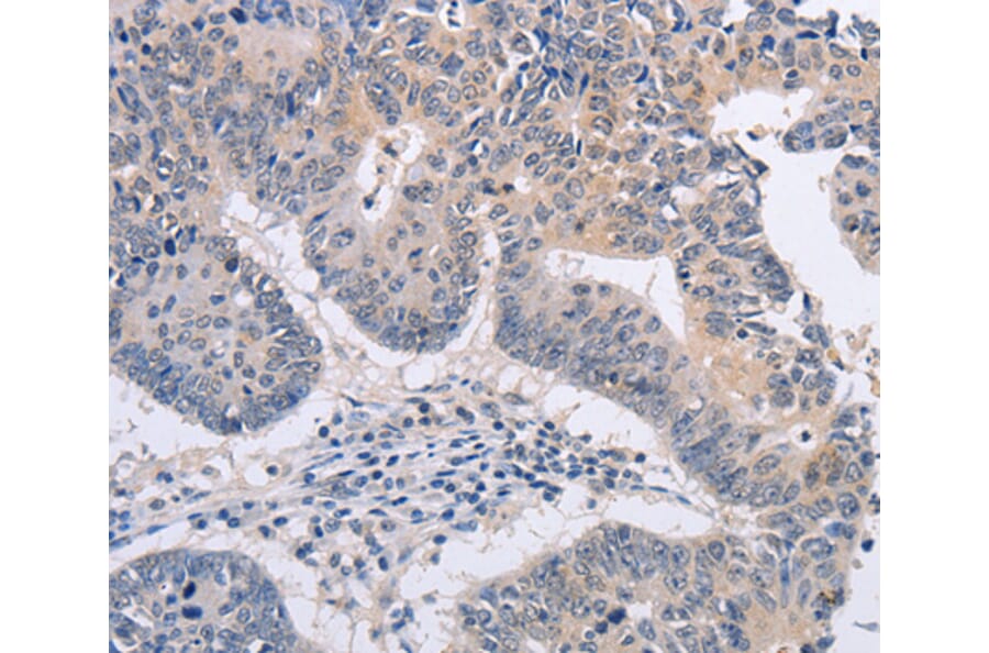 Immunohistochemistry - FBXO32 antibody from Signalway Antibody (38459) - Antibodies.com