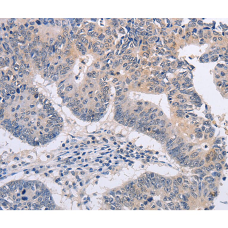 Immunohistochemistry - FBXO32 antibody from Signalway Antibody (38459) - Antibodies.com