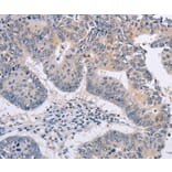 Immunohistochemistry - FBXO32 antibody from Signalway Antibody (38459) - Antibodies.com