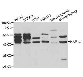 Western blot - NAP1L1 antibody from Signalway Antibody (38460) - Antibodies.com