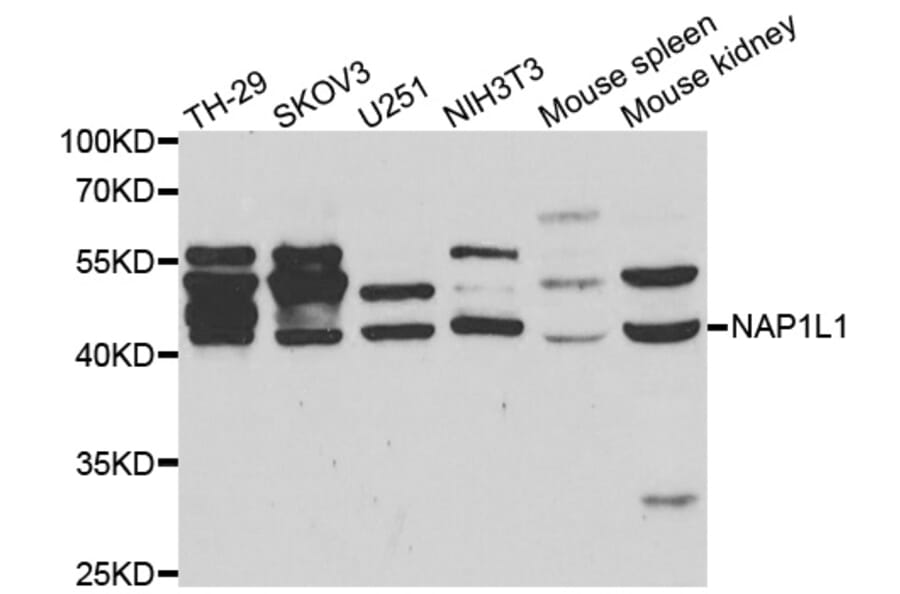 Western blot - NAP1L1 antibody from Signalway Antibody (38460) - Antibodies.com