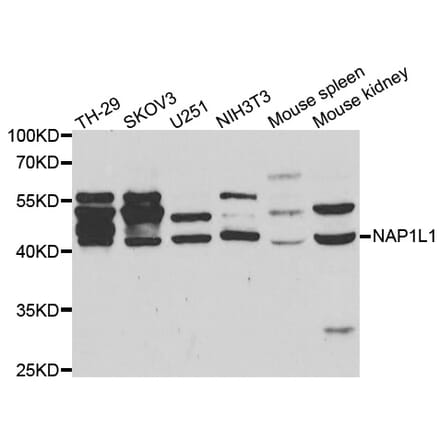 Western blot - NAP1L1 antibody from Signalway Antibody (38460) - Antibodies.com