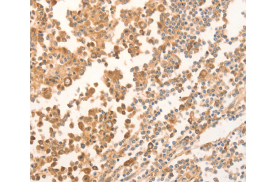 Immunohistochemistry - NAP1L1 antibody from Signalway Antibody (38460) - Antibodies.com