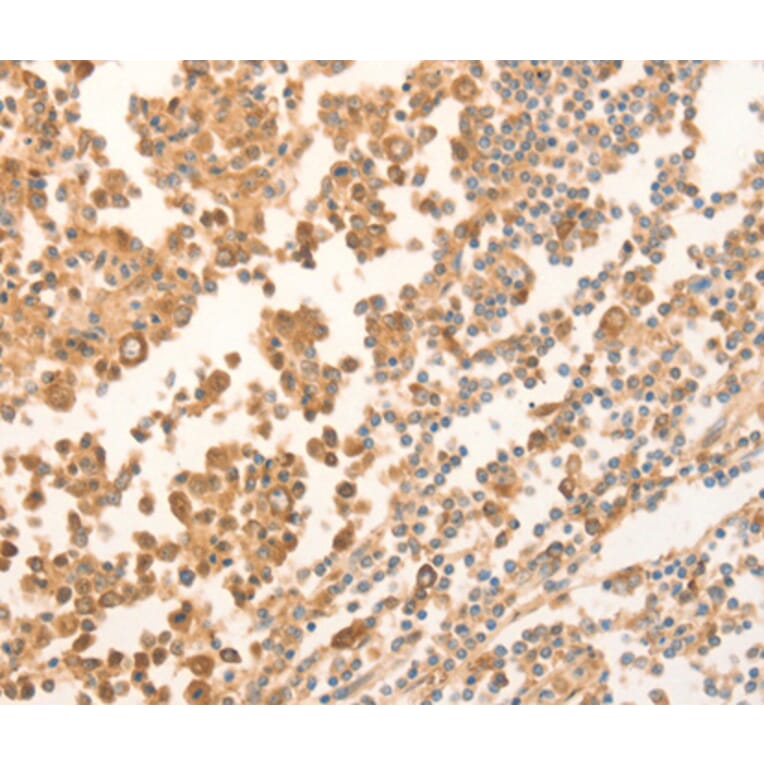 Immunohistochemistry - NAP1L1 antibody from Signalway Antibody (38460) - Antibodies.com