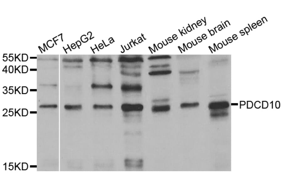 Western blot - PDCD10 antibody from Signalway Antibody (38464) - Antibodies.com