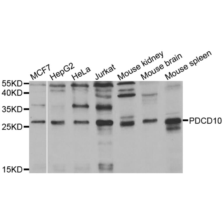 Western blot - PDCD10 antibody from Signalway Antibody (38464) - Antibodies.com